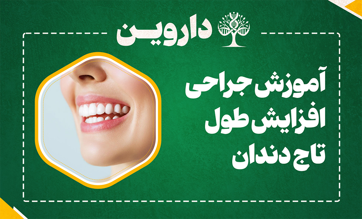 آموزش جراحی افزایش طول تاج دندان